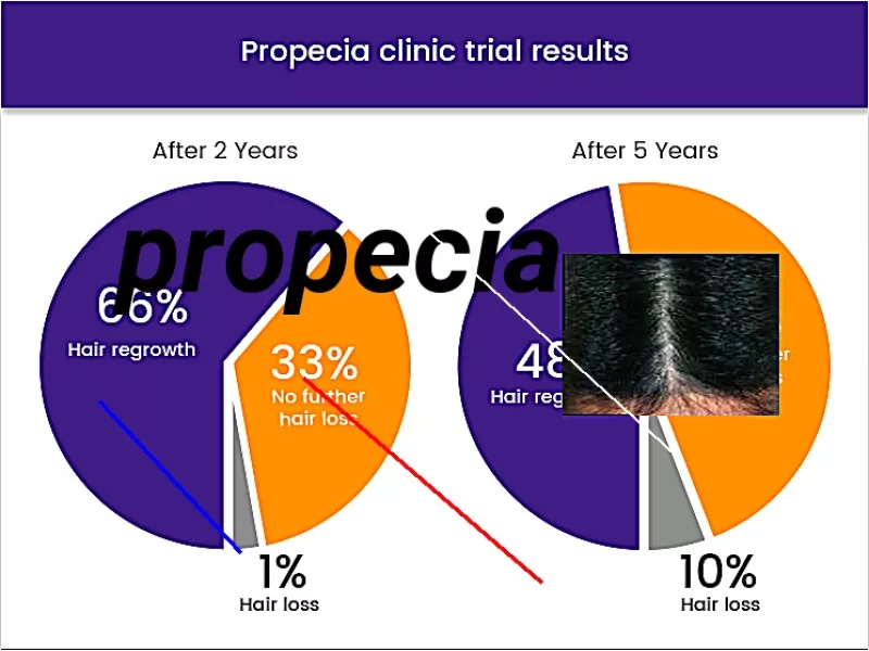 Acheter finasteride propecia